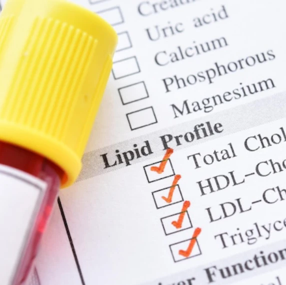 lipid